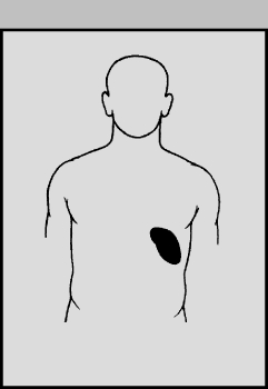 СЕЛЕЗЕНКА расположена в брюшной полости, слева, за желудком; она соприкасается также с диафрагмой, поджелудочной железой, толстым кишечником и левой почкой. Капсула селезенки срастается с брюшиной, и таким образом селезенка прикрапляется к брюшной стенке. Фиброзные тяжи - трабекулы - начинаются от капсулы, проникают внутрь органа и составляют остов селезенки. Селезеночная артерия входит через углубление, называемое воротами, делится на веточки, которые доходят до красной пульпы и впадают в венозные синусы. Оттуда кровь по мелким венам собирается в селезеночную вену, выходящую из ворот селезенки.