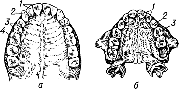 Зубы человека (верхняя челюсть).