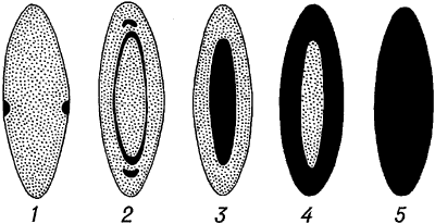 Схематическое изображение различных форм катаракты.